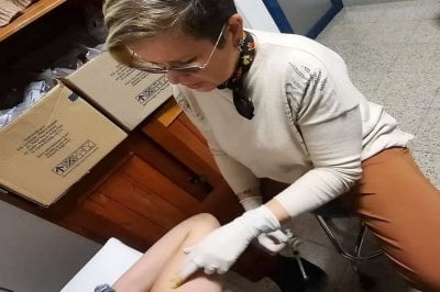 Colocación y remplazo de implantes subdérmicos gratuitos Villaguay